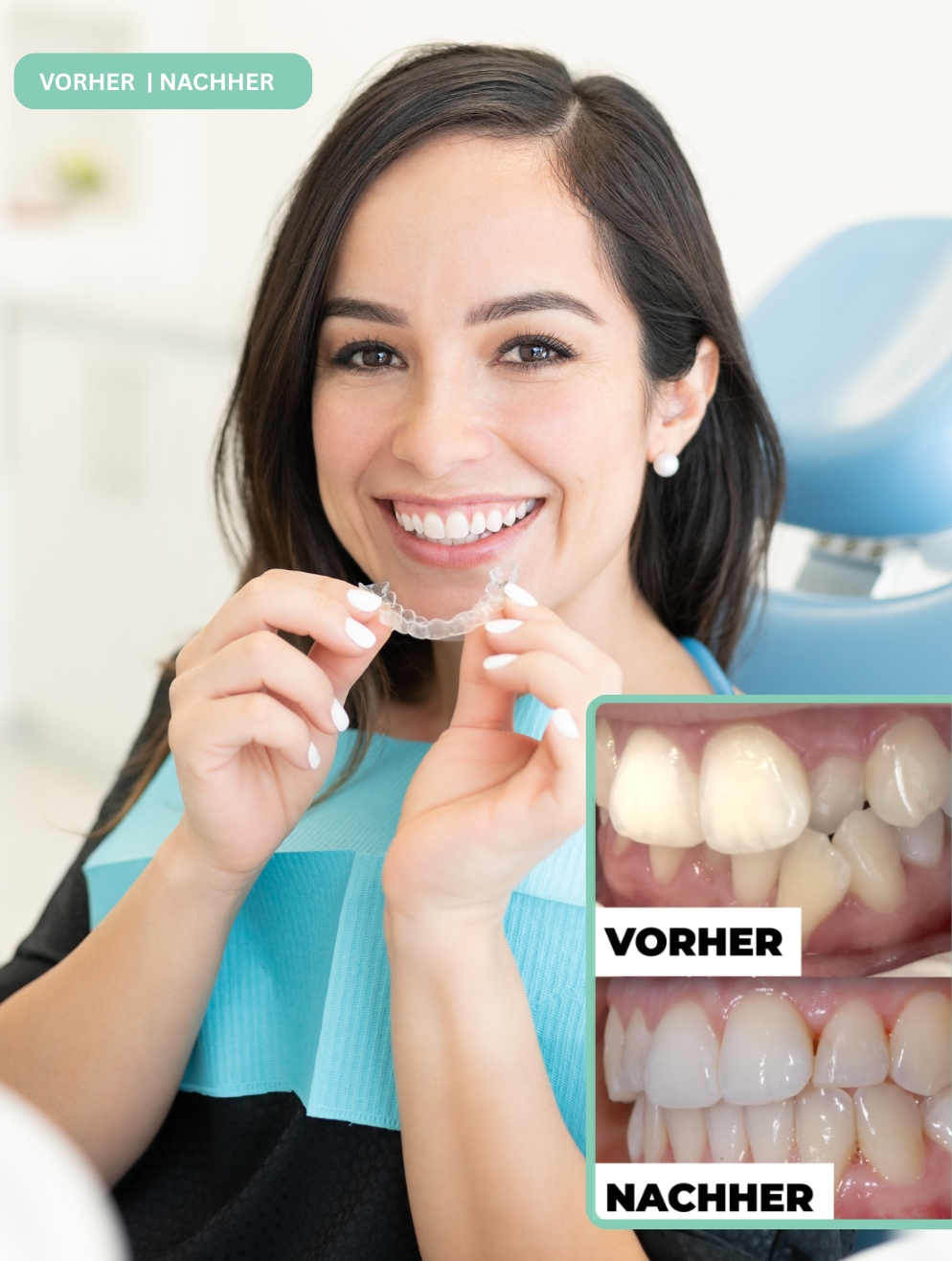 Vorher Nachher – Aligner-Behandlung bei SANFT