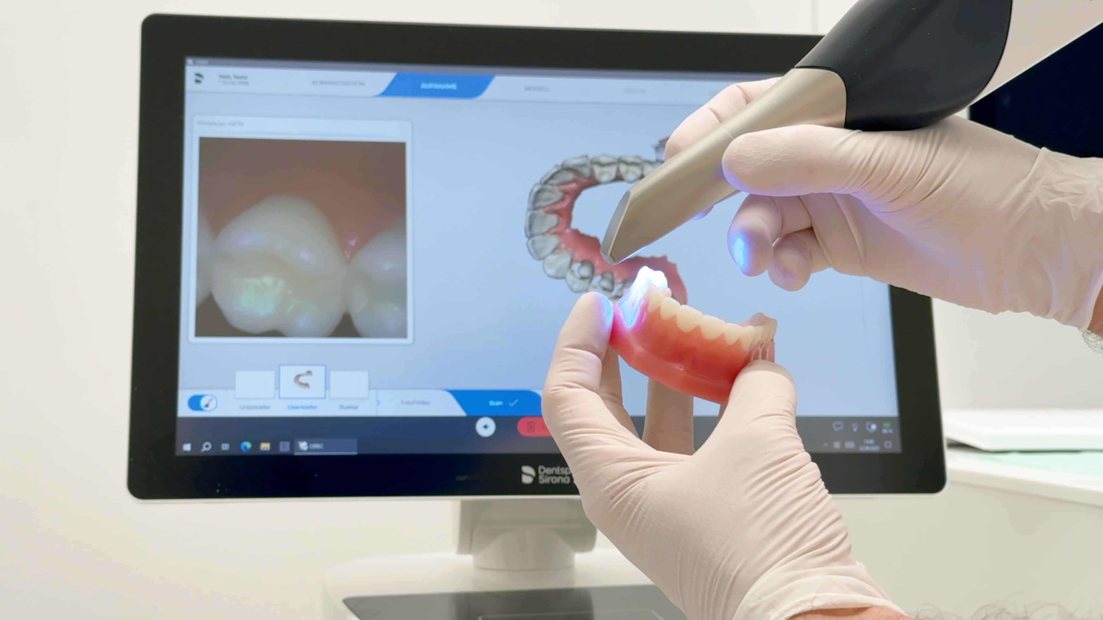3D-Scan der Zähne